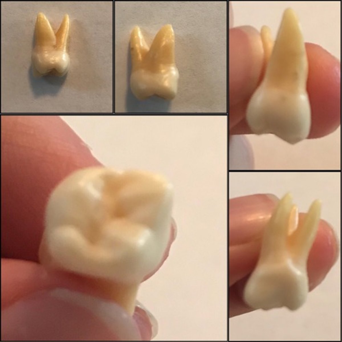 <p>What tooth is this ?</p>