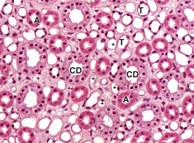 <p>CD </p>