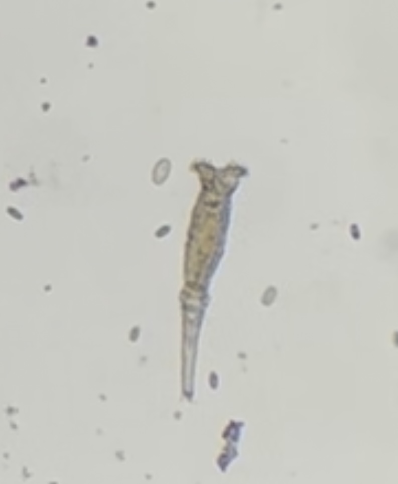 <p>Identify the organism and the Phylum it belongs to</p>