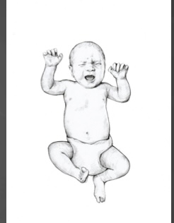 <p>This is an example of what reflex…</p>