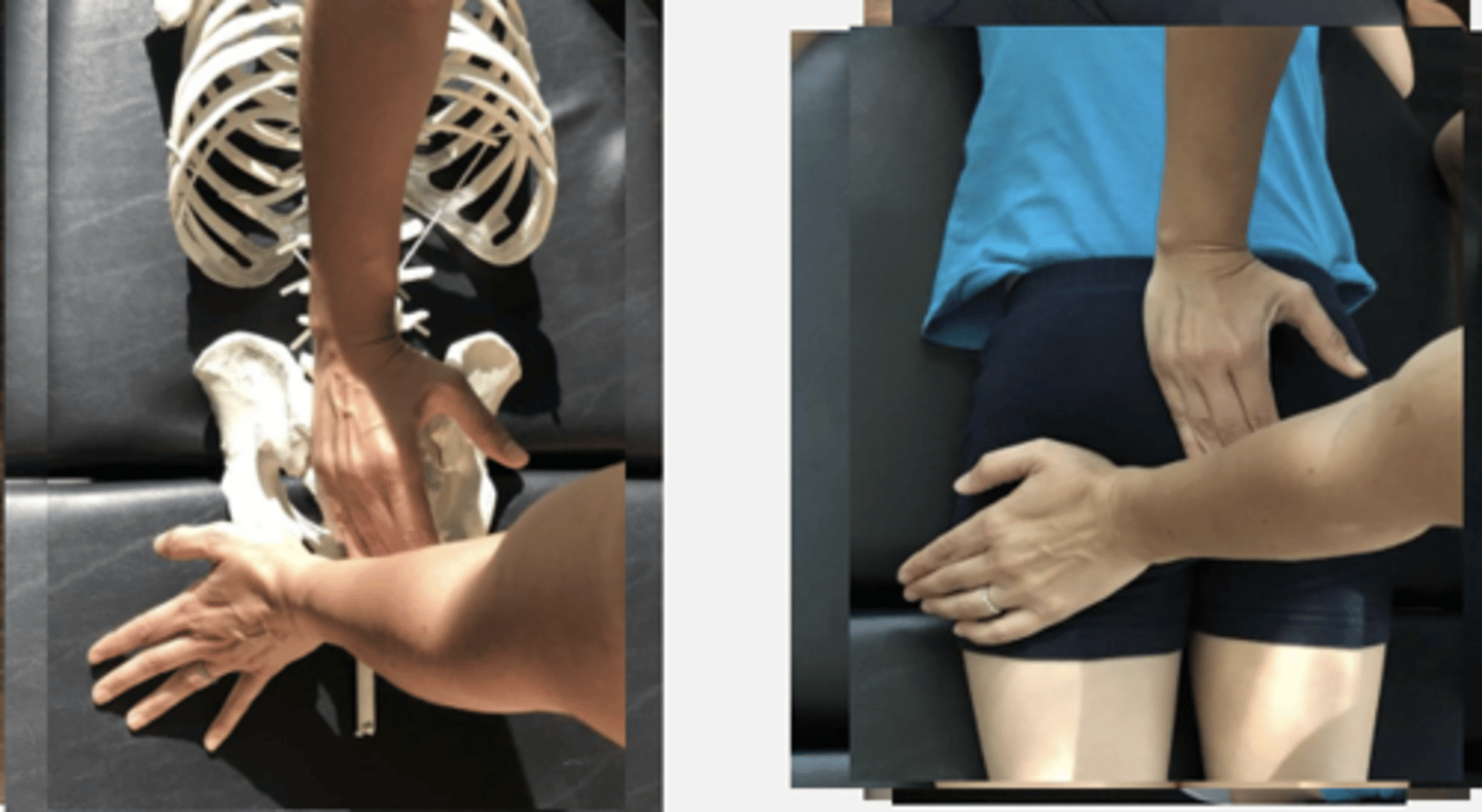 <p>PP: Prone- verbalize how you found the segment</p><p>DP: Square or Modified fencer stance on side opposite the dysfunction</p><p>CH: Caudal (L) hand, hypothenar (calcaneal) contact on (L) ischial tuberosity</p><p>IH: Cephalad ( R) hand, hypothenar(pisiform) on L sacral base(just medial to the L PSIS)</p><p>LOD: CH: P - A, S -I</p><p>IH: P -A, I - S</p>