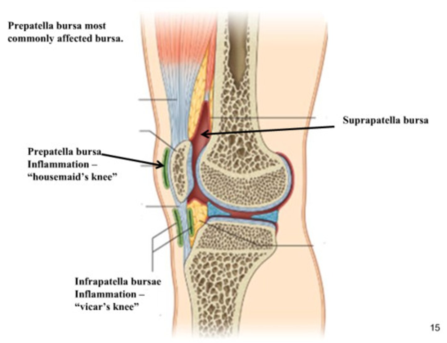 <p>A small sac filled with synovial fluid. Found in areas subject to stress. Helps ease movement.</p>