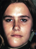 <p><span>At what age are jaw ABCs usually diagnosed?</span></p>