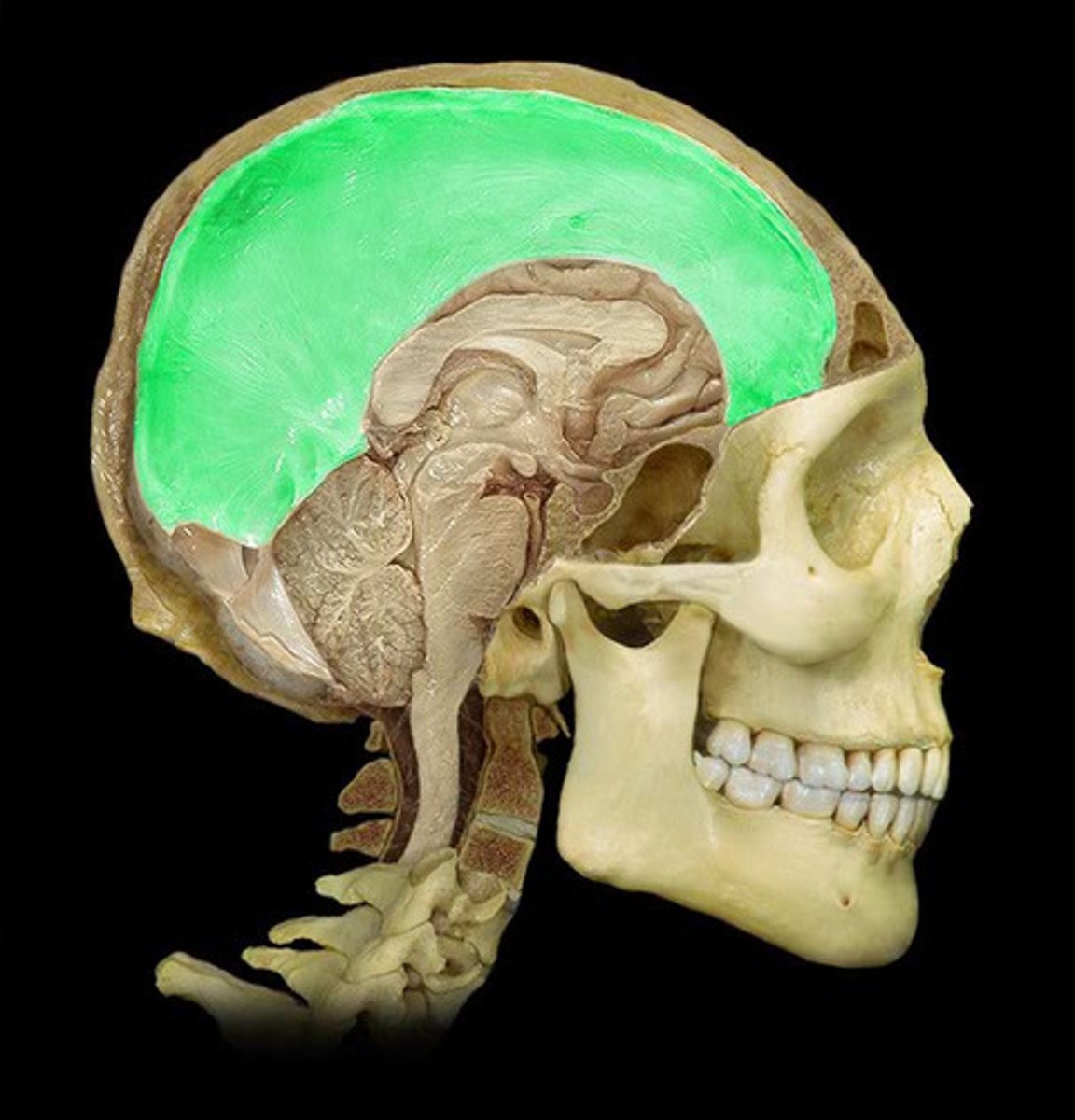 <p>- fold of dura mater that dips into the longitudinal fissure and divides cerebral hemispheres</p><p>- acts as a seatbelt -> if left hemisphere moves, falx cerebri reduces movement of right hemisphere</p>