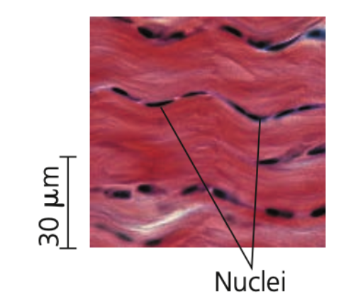 Fibrous connective tissue
➔ Dense with _______ fibers
➔ Is found in ______ (attaches muscle to bones) and _______ (connect bones at joints)
➔ May be further subdivided into:
◆ Dense regular
◆ Dense irregular