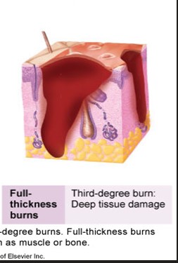 <ul><li><p>deep tissue damage </p></li><li><p>to the subcutaneous </p></li></ul>