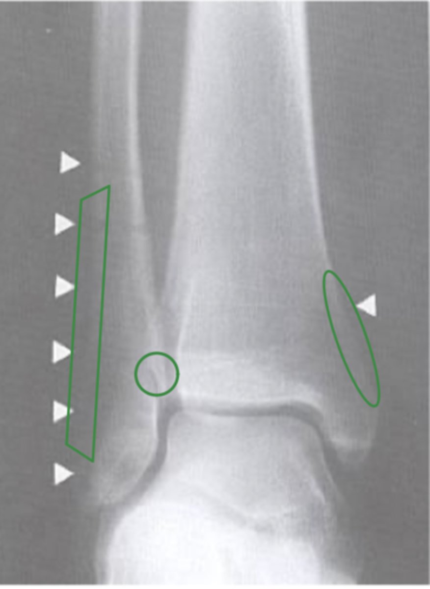 <p>What view does this show?</p>