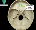 <p>superior surface of the ethmoid; perforated by a foramina which allows passage of the olfactory nerves, which provide sense of smell</p>