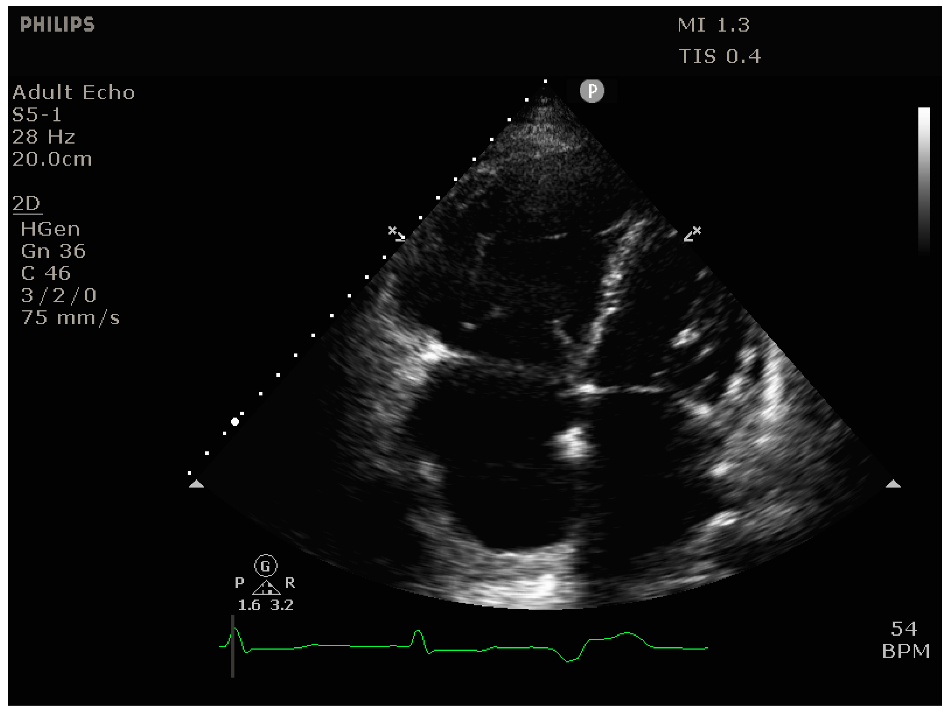 <p>Identify this view.</p>