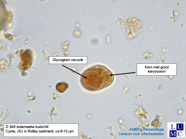 <p>Iodamoeba bütschlii</p><p></p><p>Troph= 8-20 um</p><p>Cyst= 5-20 um (usually 10-12 um)</p>