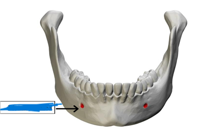 <p>What part of the skull is this?</p>