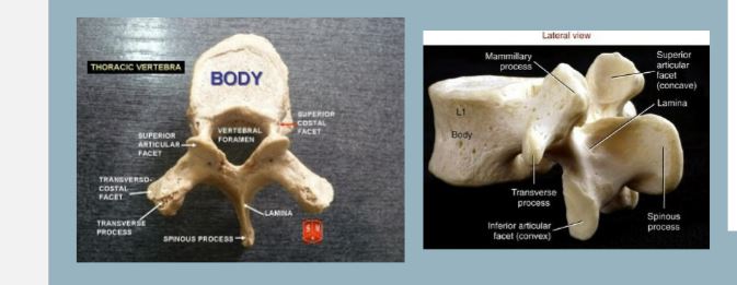 <p>Vertebral Body </p><p>Vertebral Spinous </p><ul><li><p>transverse a</p></li><li><p>articular facets </p></li><li><p>pedicle and laminae </p></li></ul><p></p>