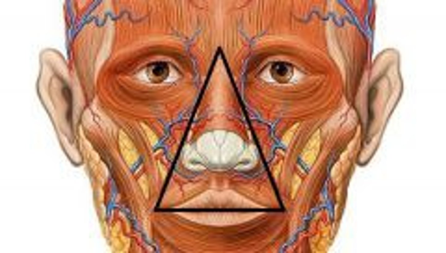 <p>bridge of nose to upper lip</p><p>highly vascular supply meaning easier to spread infection</p>