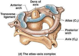 <p>Odontoid process or Dens</p>