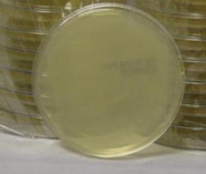 <p>tryptic soy agar (TSA)</p>