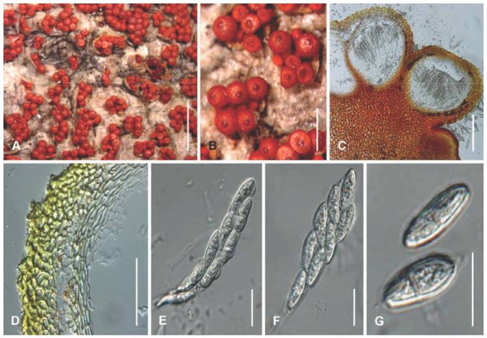<p>Gömming, cellulosa nedbrytare (ascomycota)</p>