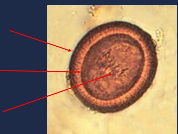 State the name of the upper portion of the picture.