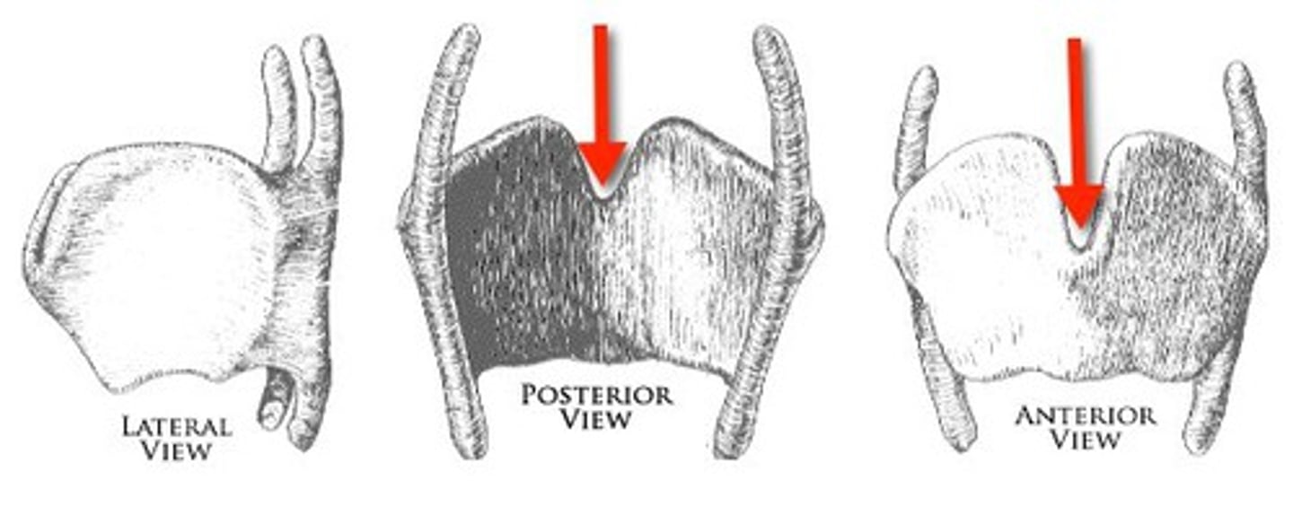 <p><em>identify the structure:</em></p>