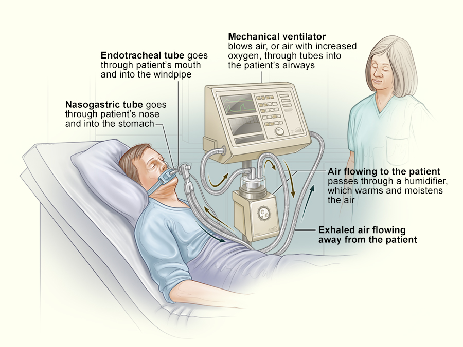 <p>What machinery makes it possible for the heart to continue to beat even though the person cannot eat, think, or breathe on his or her own?</p>