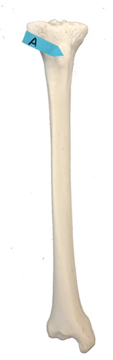<p>Identify this bone marking.</p>