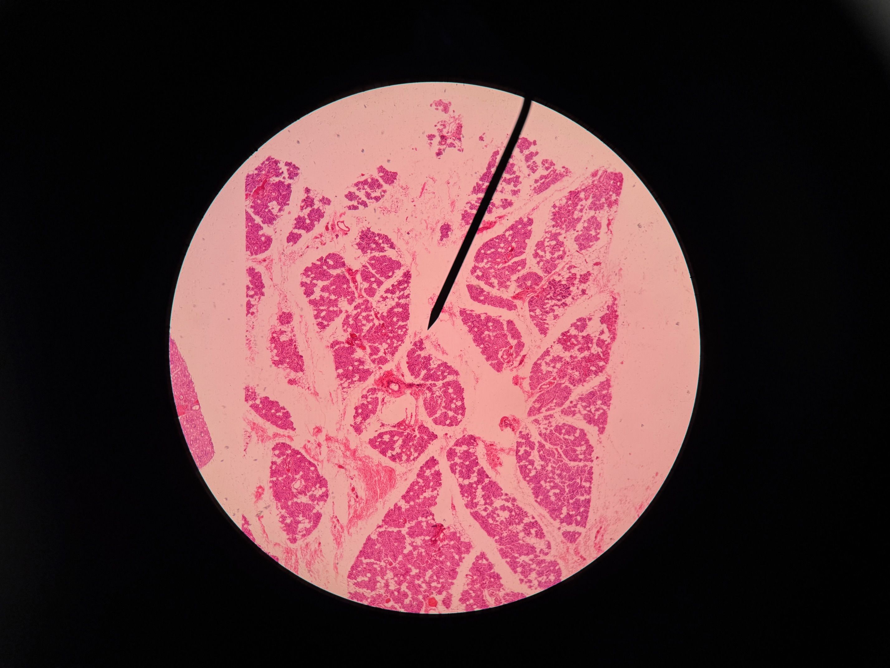 <p>Organ?</p>