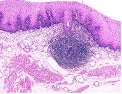 <p>what secondary lymphoid tissue?</p>