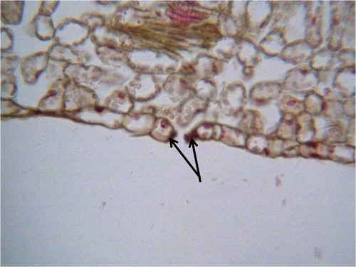 Cells which surround the stomata and control its opening and closing.