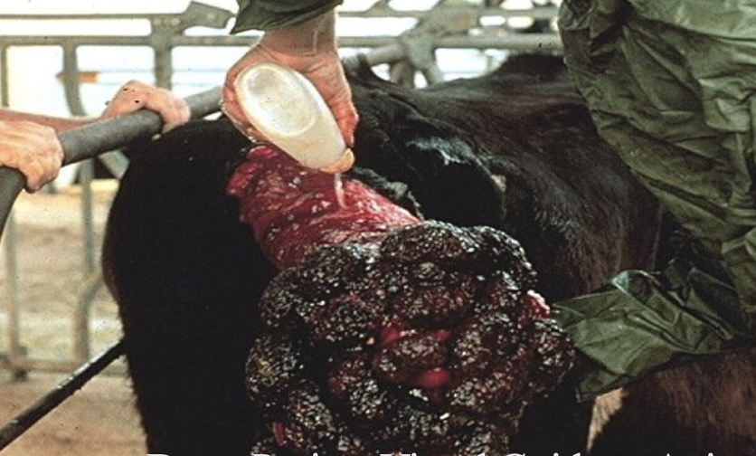 <p>yes, can remove the attached placenta if it detaches easily</p>