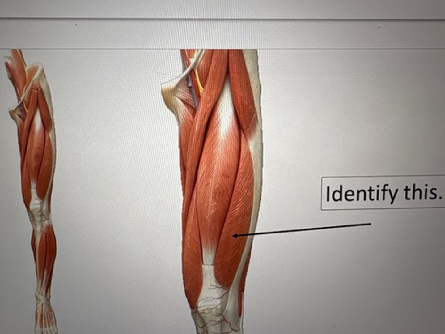 term image