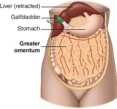 <p>“fatty apron”, drapes over intestines </p>