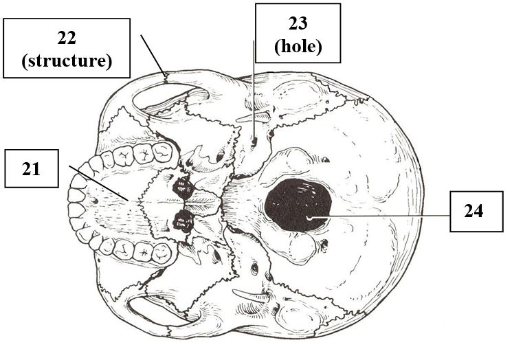 <p>Skull (inferior view)</p>