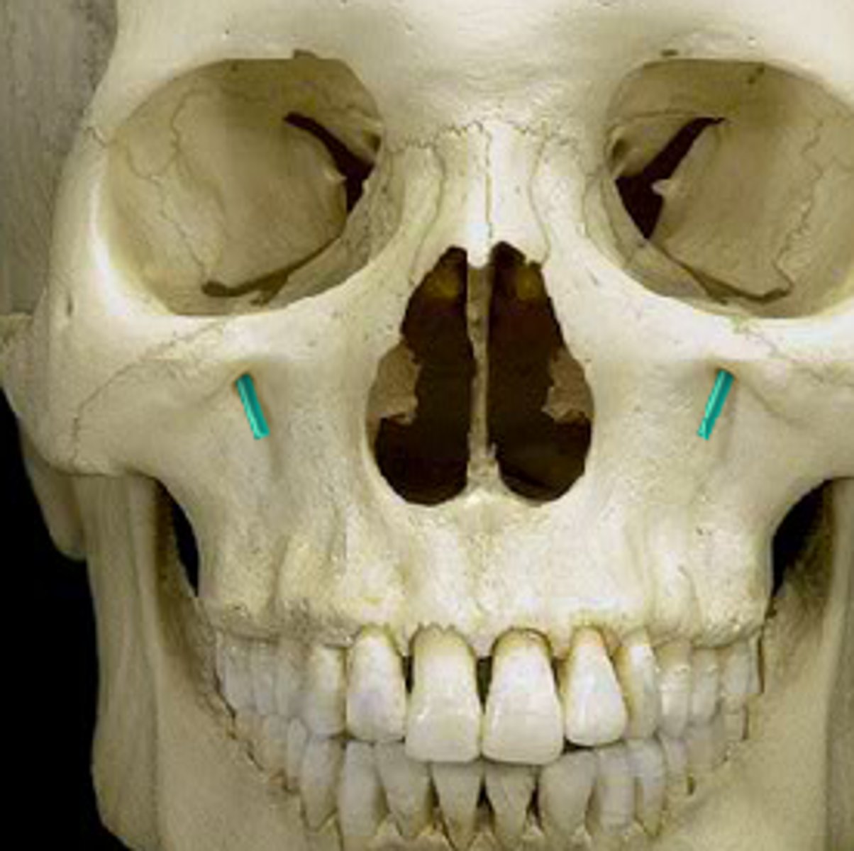 knowt flashcard image