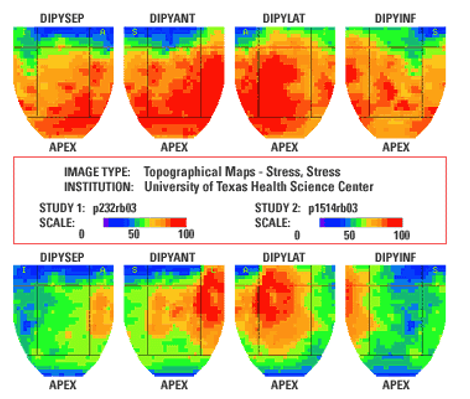 <p>What does this PET scan show? </p>