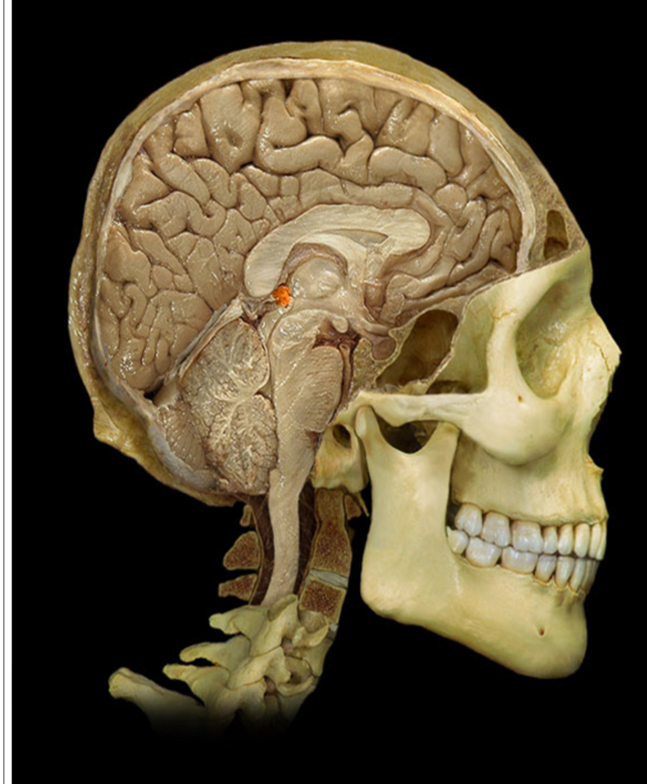 <p>What gland is this</p>