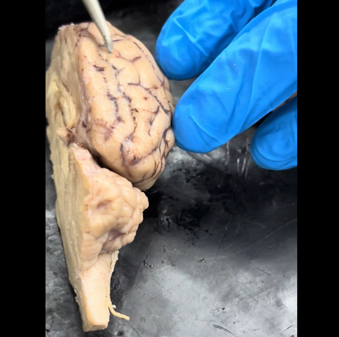 <p>What are the “hills” on the surface of the brain called?</p>