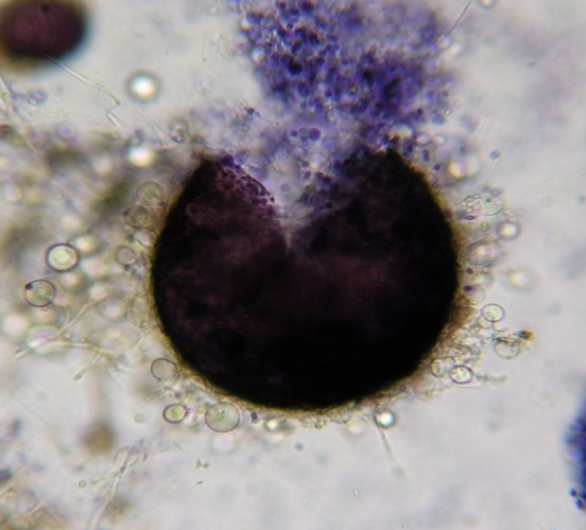 <p>Cleistothecia</p>