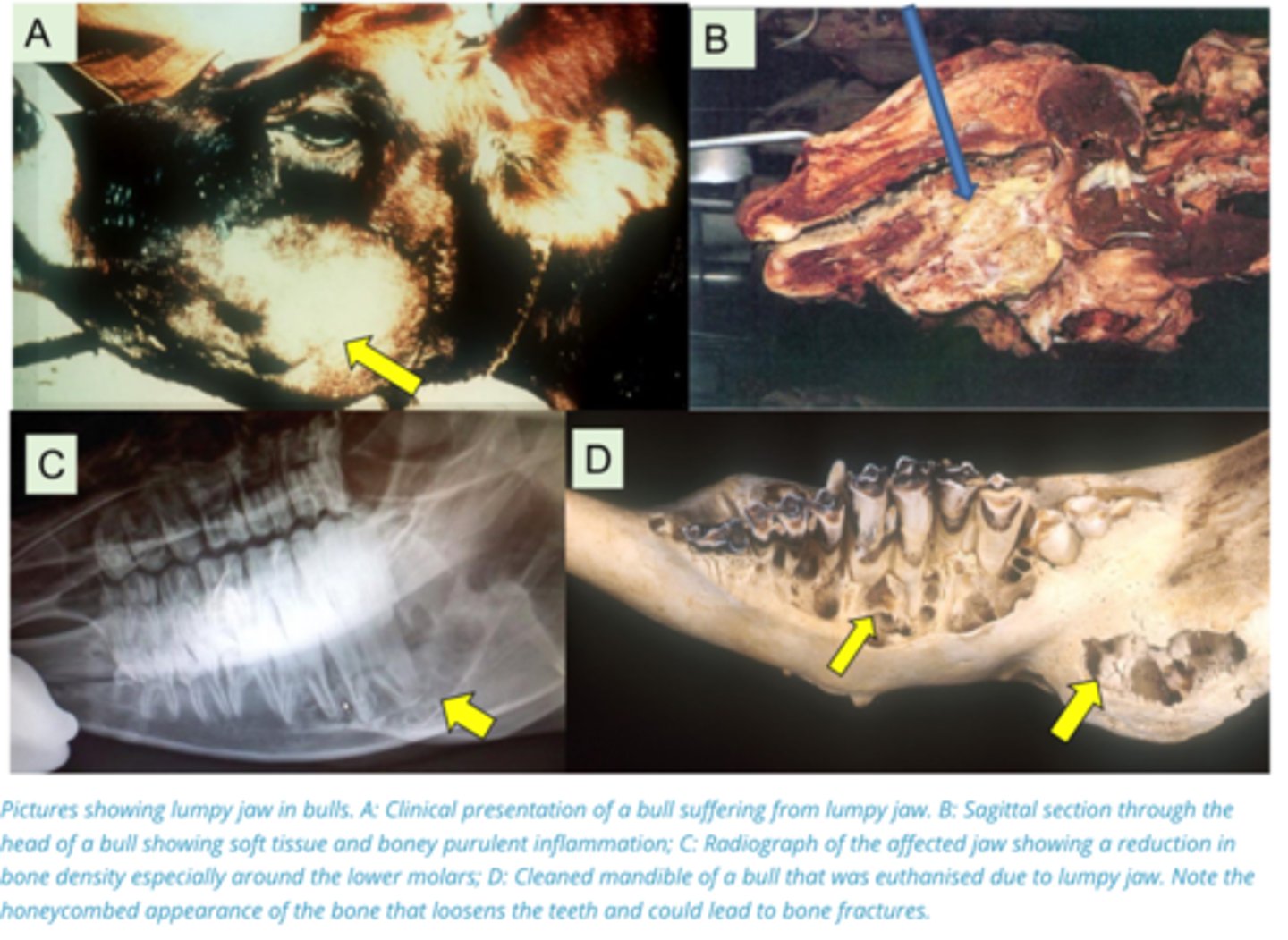 <p>1. Commensal of the Oral cavity, causes a slow progressive granulomatous disease of the jaws of 2-5 year-old cattle.</p><p>2. Occurs when there is periodontitis during change of teeth, rough feed, or grass entrapment</p><p>3. Organism gets under teeth and grows slowly → Infects bone → Bone remodelling around bacteria → Bone becomes expanded, porous, and weak</p>