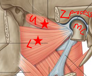 <p>Lateral Pterygoid (2 heads - Upper + Lower)</p><p><strong>Origin -</strong> U-infratemporal fossa / L-lateral side of lateral pterygoid plate </p><p><strong>Insertion -</strong> Temporomandibular joint capsule / neck of mandible</p><p><strong>Fxn -</strong> Protrude mandible / Move mandible side to side</p><p><strong>N -</strong> Mandibular branch of trigeminal N</p>