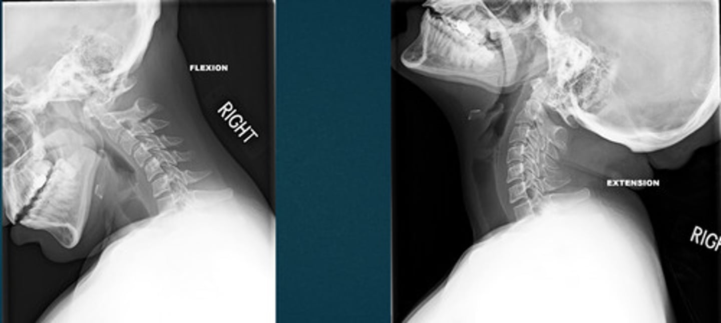 <p>What projection view is this?</p>