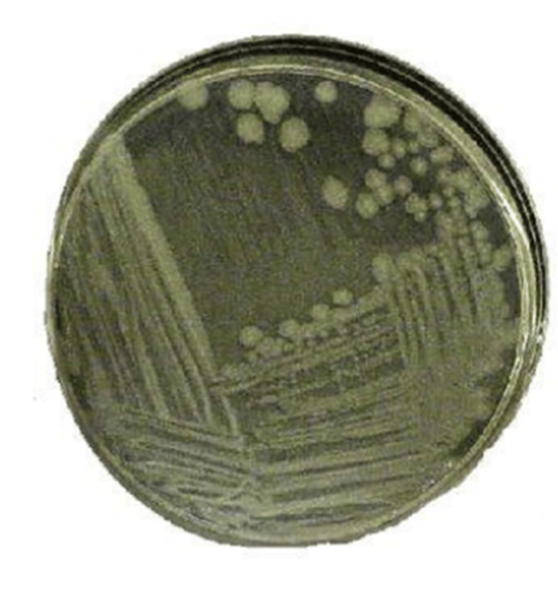 <p>Method used to separate a mixed culture and develop isolated colonies</p>