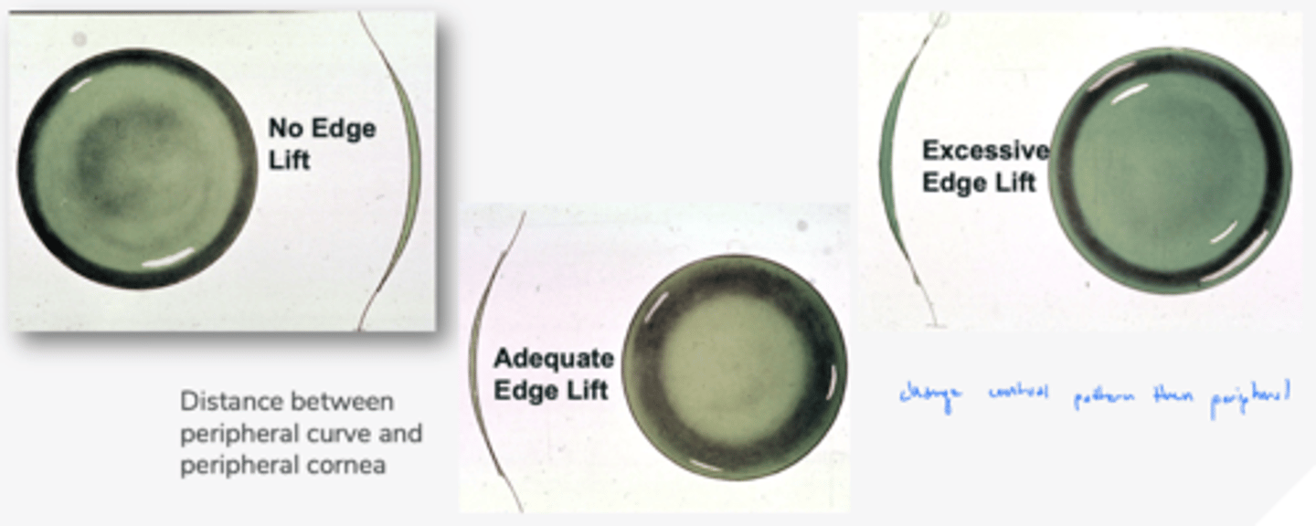 <p>1. adequate</p><p>2. excessive</p><p>3. minimal</p>