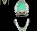 <p>The portion of the maxillary bone that forms most of the hard palate. It consists of 2 pieces of bone that grow and fuse at the midline during the fetal stage.</p>