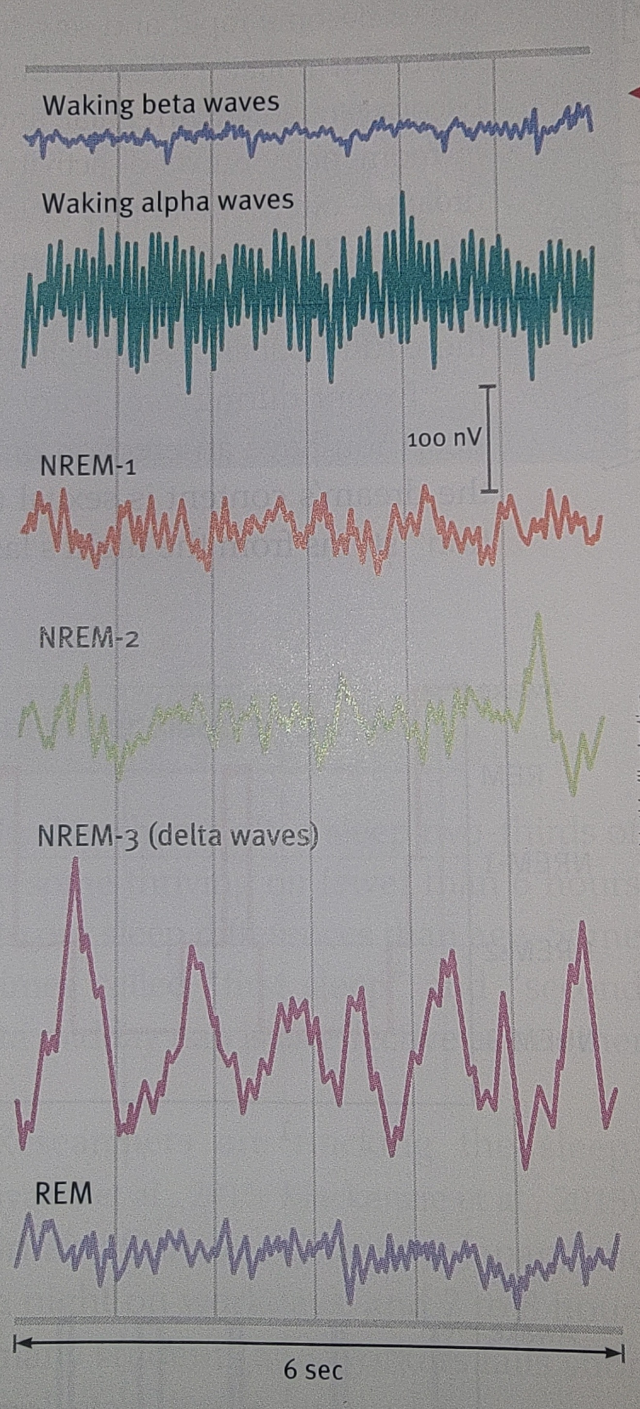<p>identified by their specific EEG patterns</p><ol><li><p>Alpha waves- When you are in bed with your eyes closed you are in an awakened but relaxed state.</p><p>Alpha waves are slow brain waves.</p></li><li><p>NREM-1 stage- You grow tired and slip into sleep. This transition is marked by slowed breathing and irregular brain waves. This is non-rapid eye movement sleep.</p><p>NREM sleep occurs in stages 1-3, encompassing all sleep stages except for REM sleep, and decreases in duration throughout the cycle.</p><p>During NREM-1 you may experience hallucinations(false sensory experiences, such as seeing something in the absence of an external visual stimulus).</p><p>You may also have the sensation of falling or of floating weightlessly. These are hypnagogic sensations (bizarre experiences while transitioning to sleep) and they may stay in your memory.</p></li><li><p>NREM-2 stage- You then relax more deeply and begin about 20 minutes of NREM-2 sleep.</p><p>In this stage you have sleep spindles( bursts of rapid, rhythmic, brain-wave activity)</p><p>You could still be awakened without much difficulty, but you’re still asleep</p><p>You spend about half of your night here</p></li><li><p>NREM-3 stage- Then you transition to the deep sleep of NREM-3. This sleep lasts for about 30 minutes</p><p>Your brain emits large, slow delta waves</p><p>You are hard to awaken</p></li><li><p>REM sleep- About an hour after you first fall asleep, not directly after NREM-3, This is rapid eye movement sleep</p><p>For about 10 minutes, your brain waves become rapid and saw-toothed, more like those of nearly awake NREM-1 which is why REM is considered paradoxical because it produces waves similar to wakefulness, but the body is at its most relaxed</p><p>But unlike NREM-1, during REM sleep your heart rate rises, your breathing becomes rapid and irregular, and every half minute or so your closed eyes dart around in momentary bursts of activity</p><p>These eye movements announce the beginning of a dream-often emotional, usually story-like, and richly hallucinatory</p><p>body Is paralyzed</p><p>The frequency of REM sleep typically increases as the cycle progresses</p><p>REM rebound- We need REM sleep. Deprived of it by repeated awakenings, people return more and more quickly to the REM stage after falling back to sleep. When finally allowed to sleep undisturbed, they sleep like babies-with increased REM sleep, a phenomenon called REM rebound</p></li></ol><p></p>