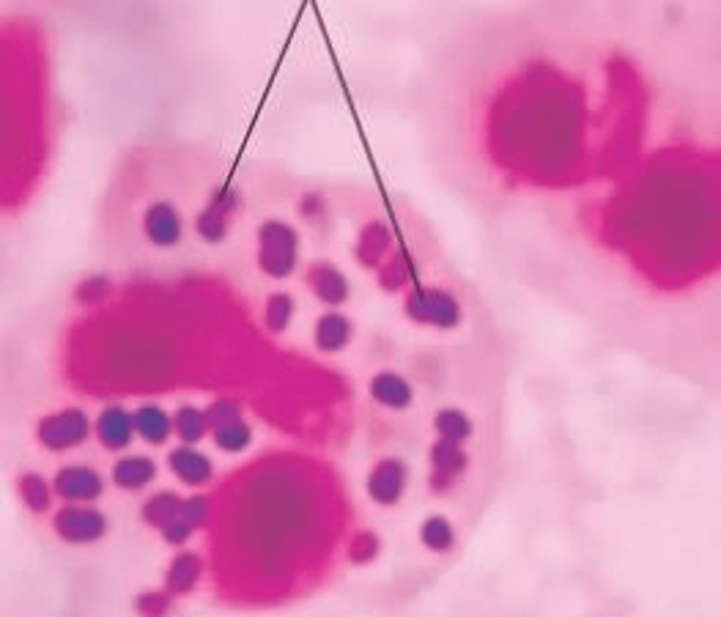 <p>NAAT (Nucleic Acid Amplification Test) via vaginal/cervical swab or first-catch urine.</p>