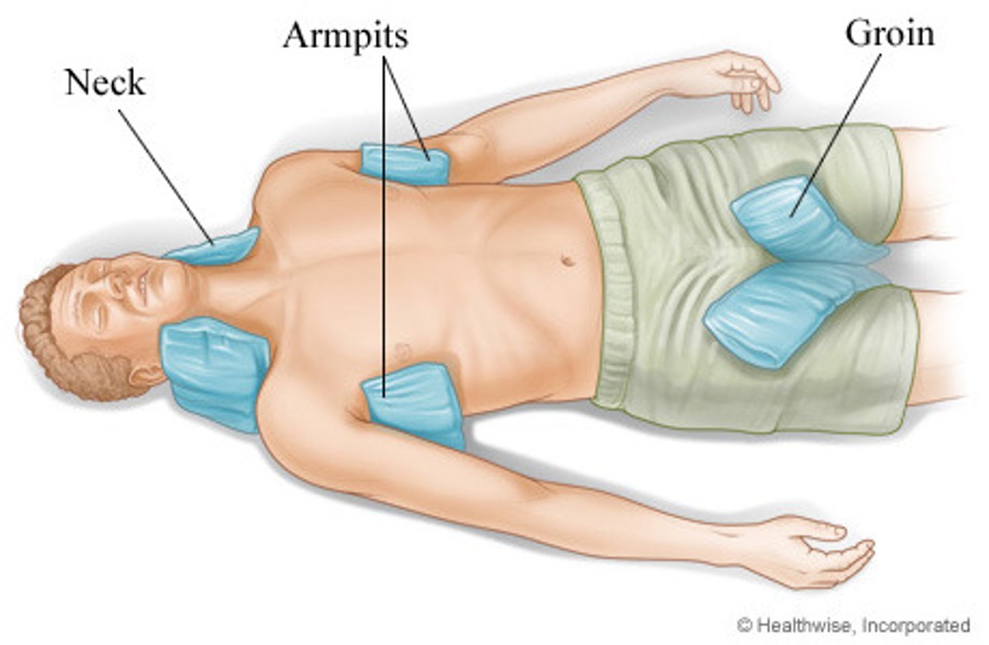 <p>seek medical help, move to cool place, cool body rapidly by immersing victim in cool (not cold) water or placing icepacks where large blood vessels are; only give food/water if not vomiting</p>