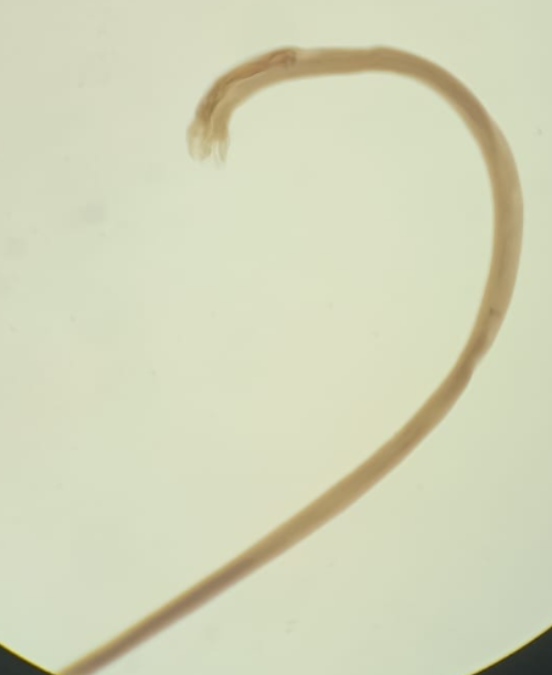 <p>Trichostrongylus axei</p>