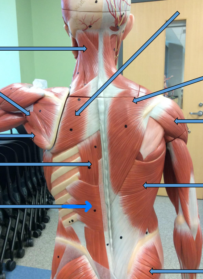 <p>Identify this muscle?</p>