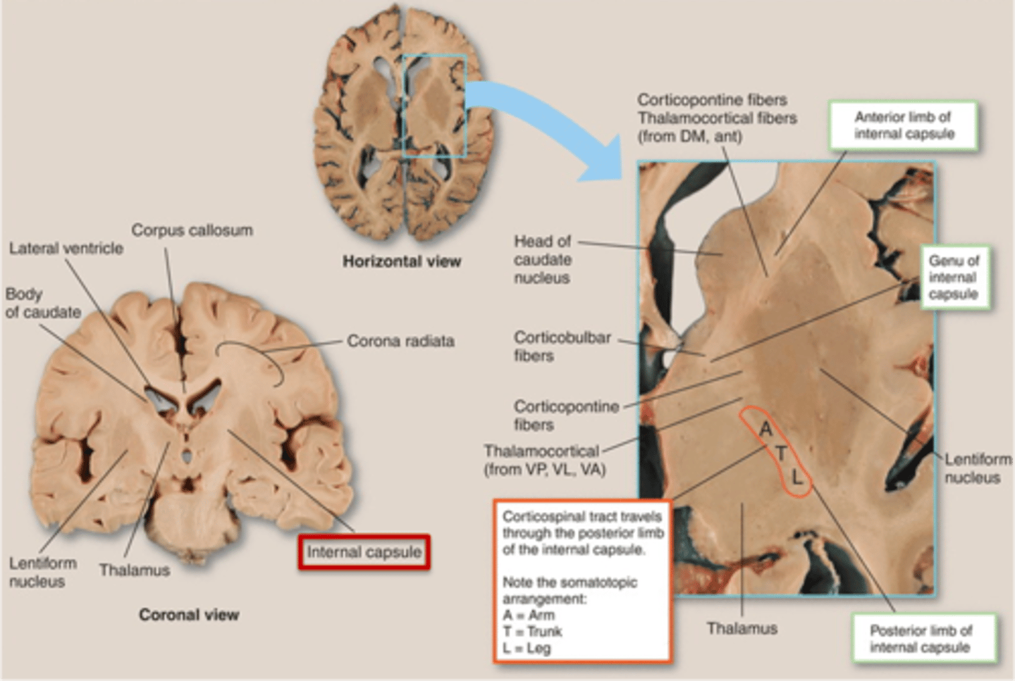 <p>internal capsule</p>