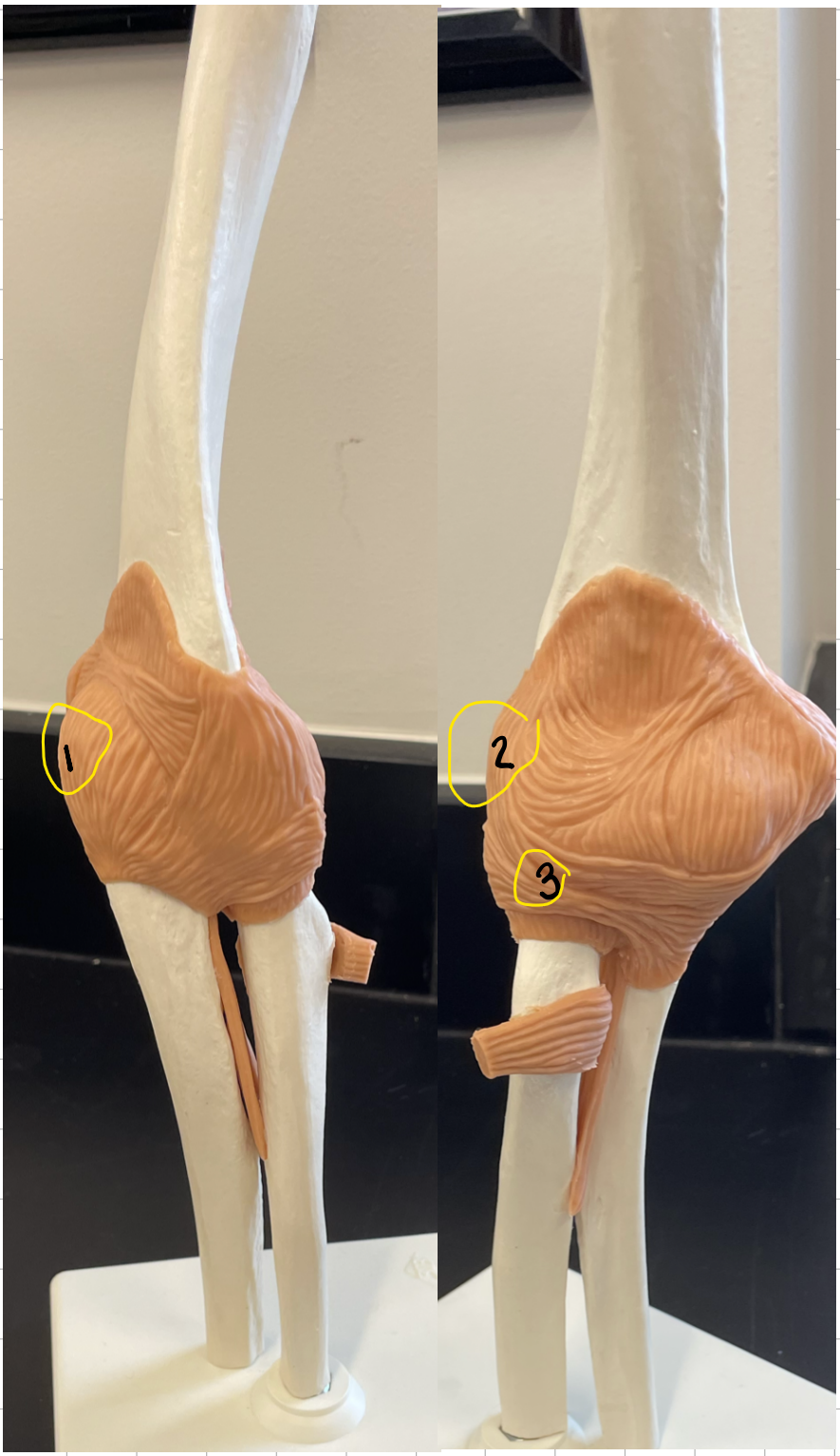 <p>what joint is this</p>