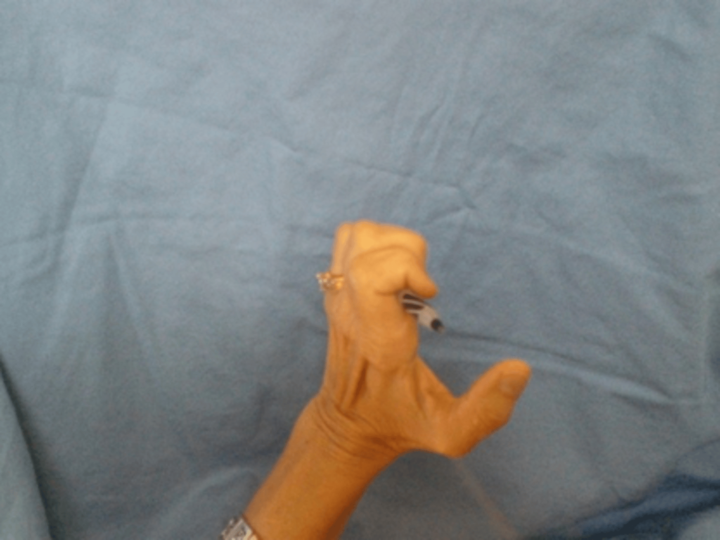 <p>PIP + DIP flexion (hook), then MCP extension</p>